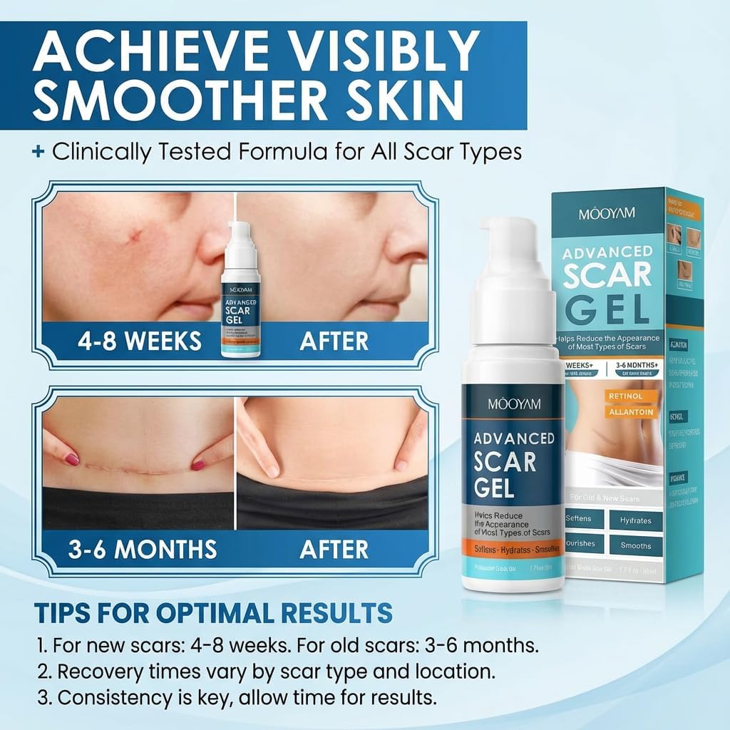 Advanced Scar Gel Silicone Based Skin Smoothing Formula 60 g