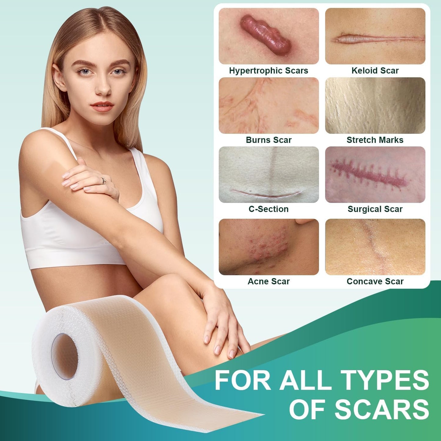 Silicone Scar Tape – Medical Grade Adhesive Strips for Scar Care  for All Skin Types